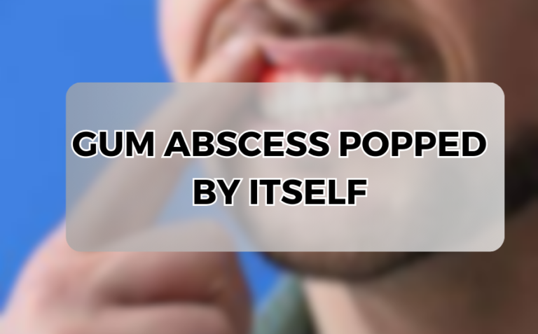 When a Gum Abscess Pops By Itself